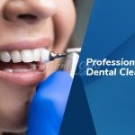 professional-dental-cleaning