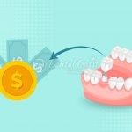 dental bridge cost without insurance