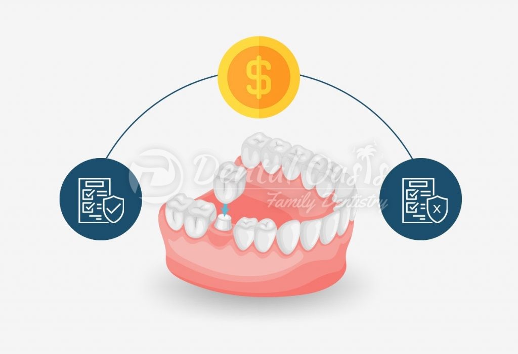 Cost of Dental Crowns with/without insurance Dental Oasis Pleasanton